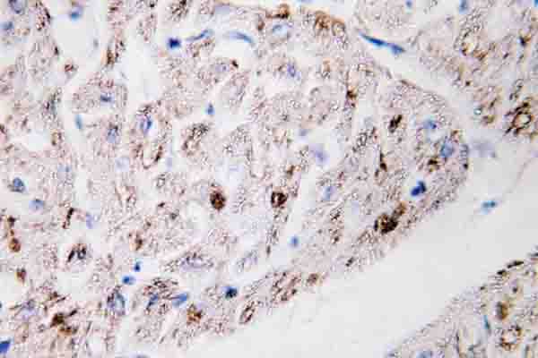 TNFAIP1 Antibody (Ser122)
