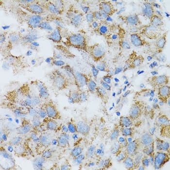 PSMD10 / Gankyrin Antibody