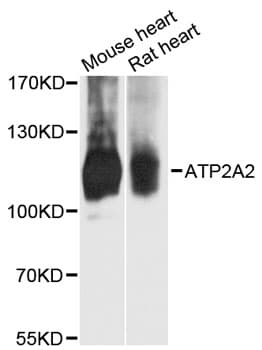 ATP2A2 / SERCA2 Antibody