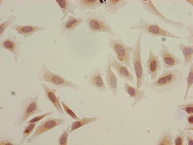 Polyclonal Rabbit anti-Human HIST1H3A Antibody (IHC)