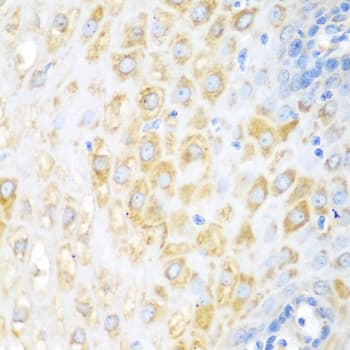 BECN1 / Beclin-1 Antibody