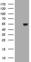 TP / Thymidine Phosphorylase Antibody (clone OTI1H7)