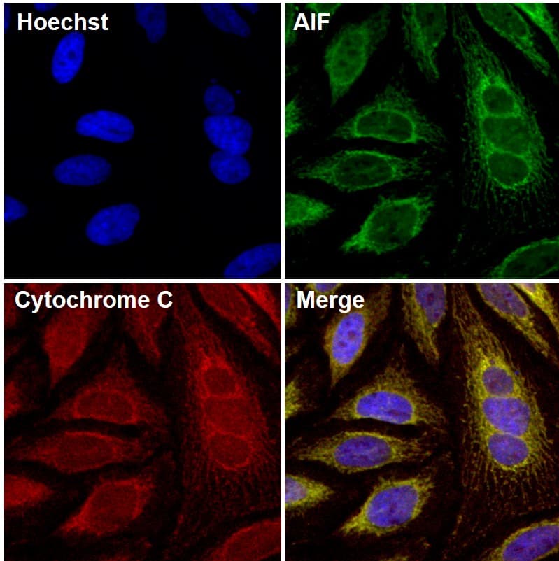 AIFM1 / AIF / PDCD8 Antibody (clone 4E7E11)