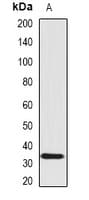 Polyclonal Rabbit anti-Human SCO1 Antibody (IHC, WB)