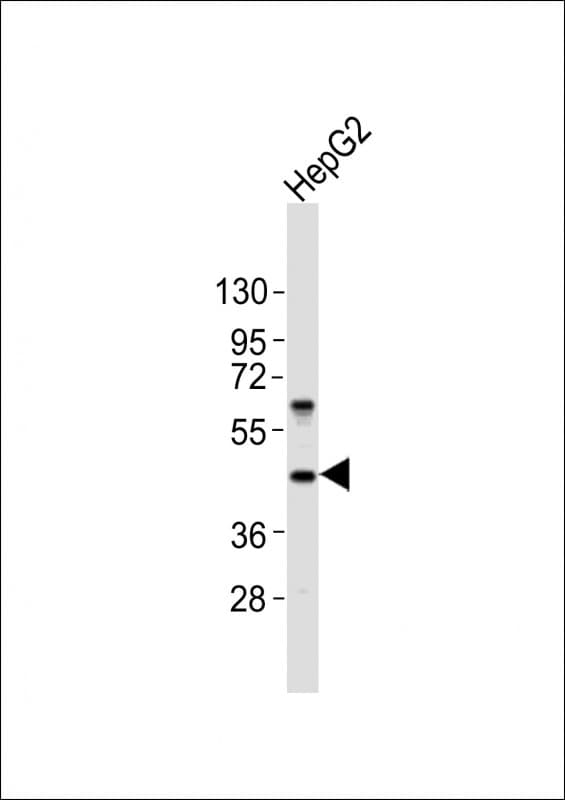 Polyclonal Rabbit anti-Human NODAL Antibody (WB)