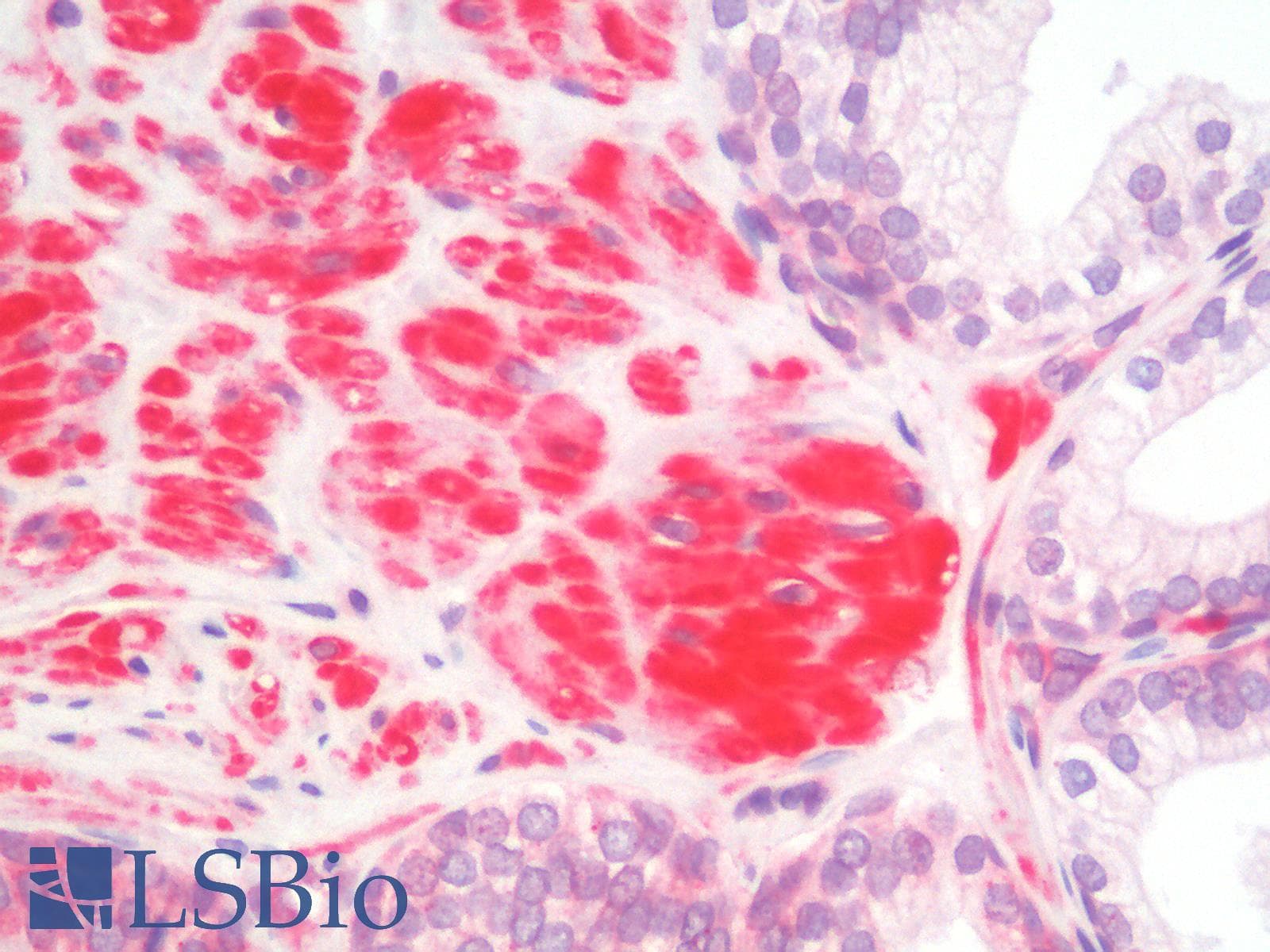 PathPlus™ Polyclonal Rabbit anti-Human SIAH2 Antibody (aa216-244, IHC, WB)