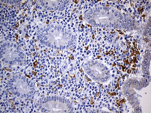 Monoclonal Mouse anti-Human CD68 Antibody (clone OTI2E2, aa22-319, IHC, WB)