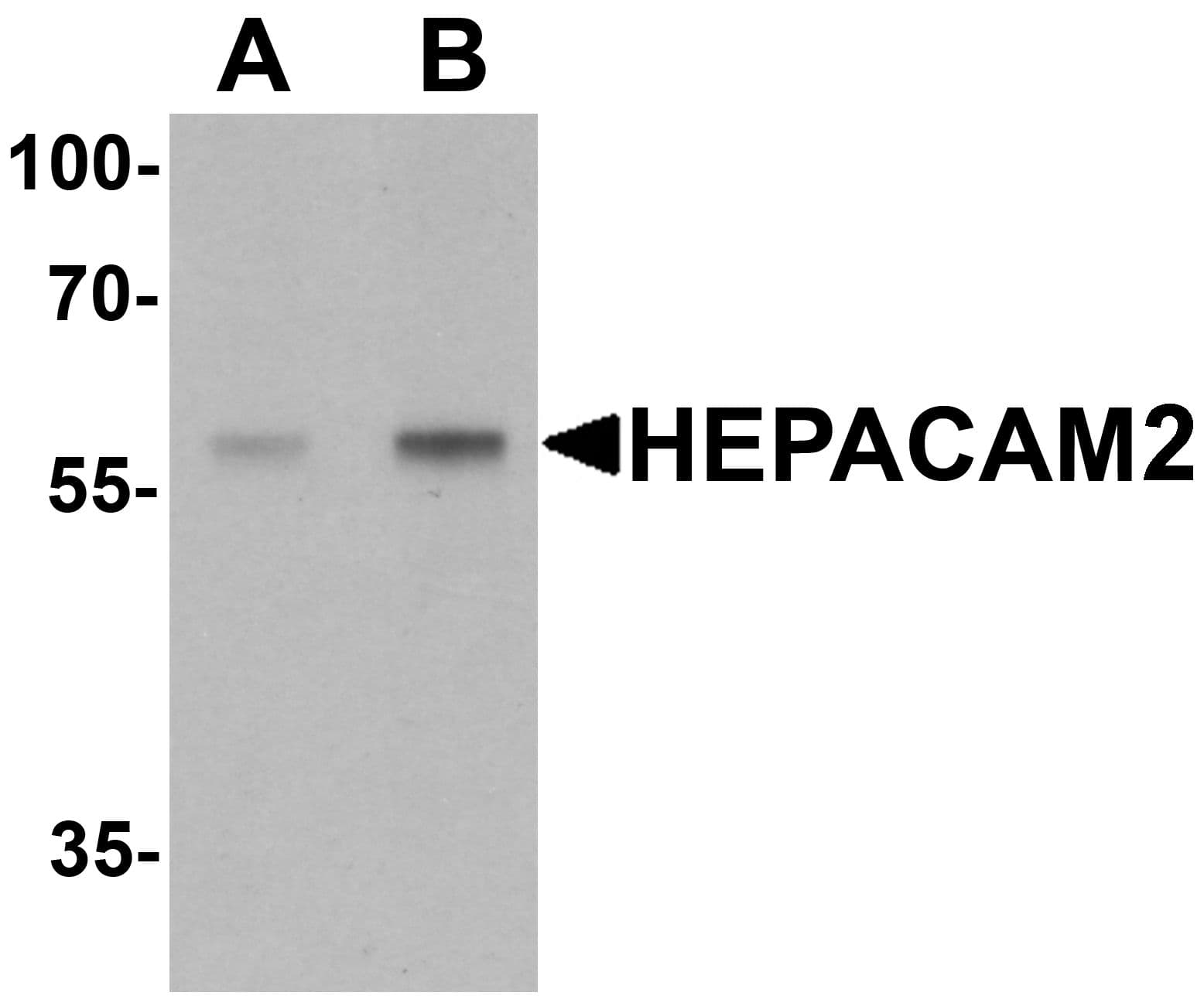 IHC-plus™ HEPACAM2 Antibody