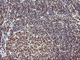 EXOSC7 Antibody (clone OTI1G8)