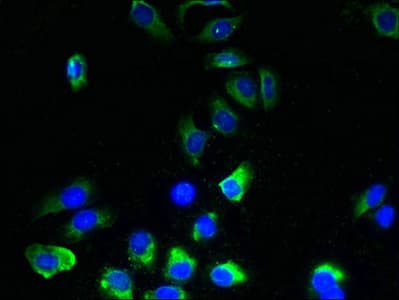 Polyclonal Rabbit anti-Human TMEM243 Antibody (IHC)