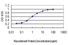 IHC-plus™ RPS6KB1 / P70S6K / S6K Antibody (clone 1E12)