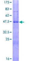 Human HESX1 Protein (Recombinant GST)