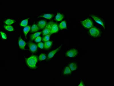 G2E3 / KIAA1333 Antibody