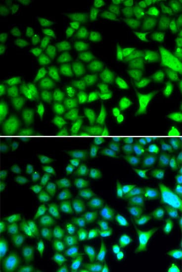 FRA-1 / FOSL1 Antibody
