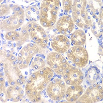 PNLIP / PL / Pancreatic Lipase Antibody