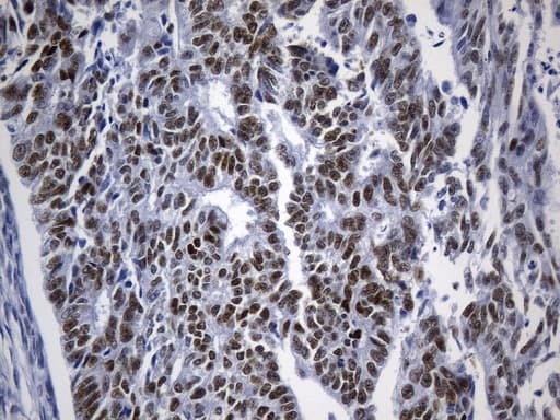 TLE1 / TLE 1 Antibody (aa180-460, clone UMAB253, Carrier-free)