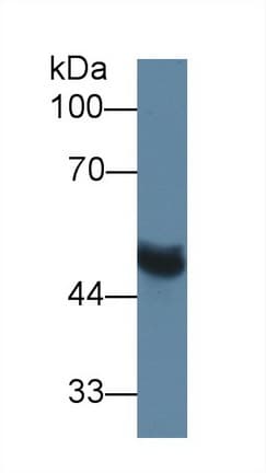 MMP13 Antibody (aa62-217)