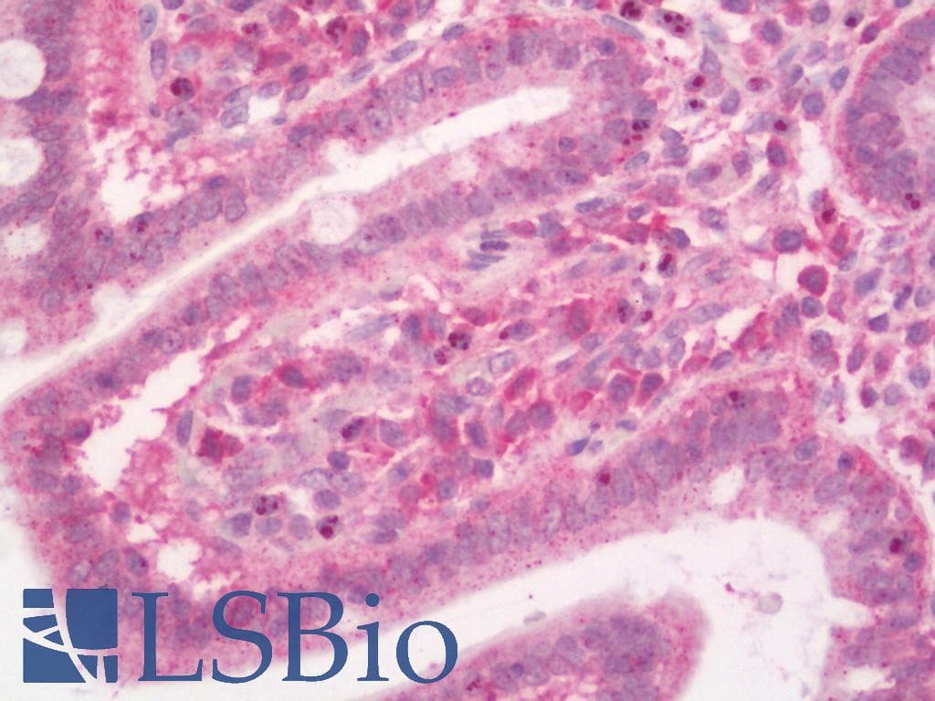 IHC-plus™ Polyclonal Rabbit anti-Human PLEKHA8 Antibody (aa122-400, IHC, WB)
