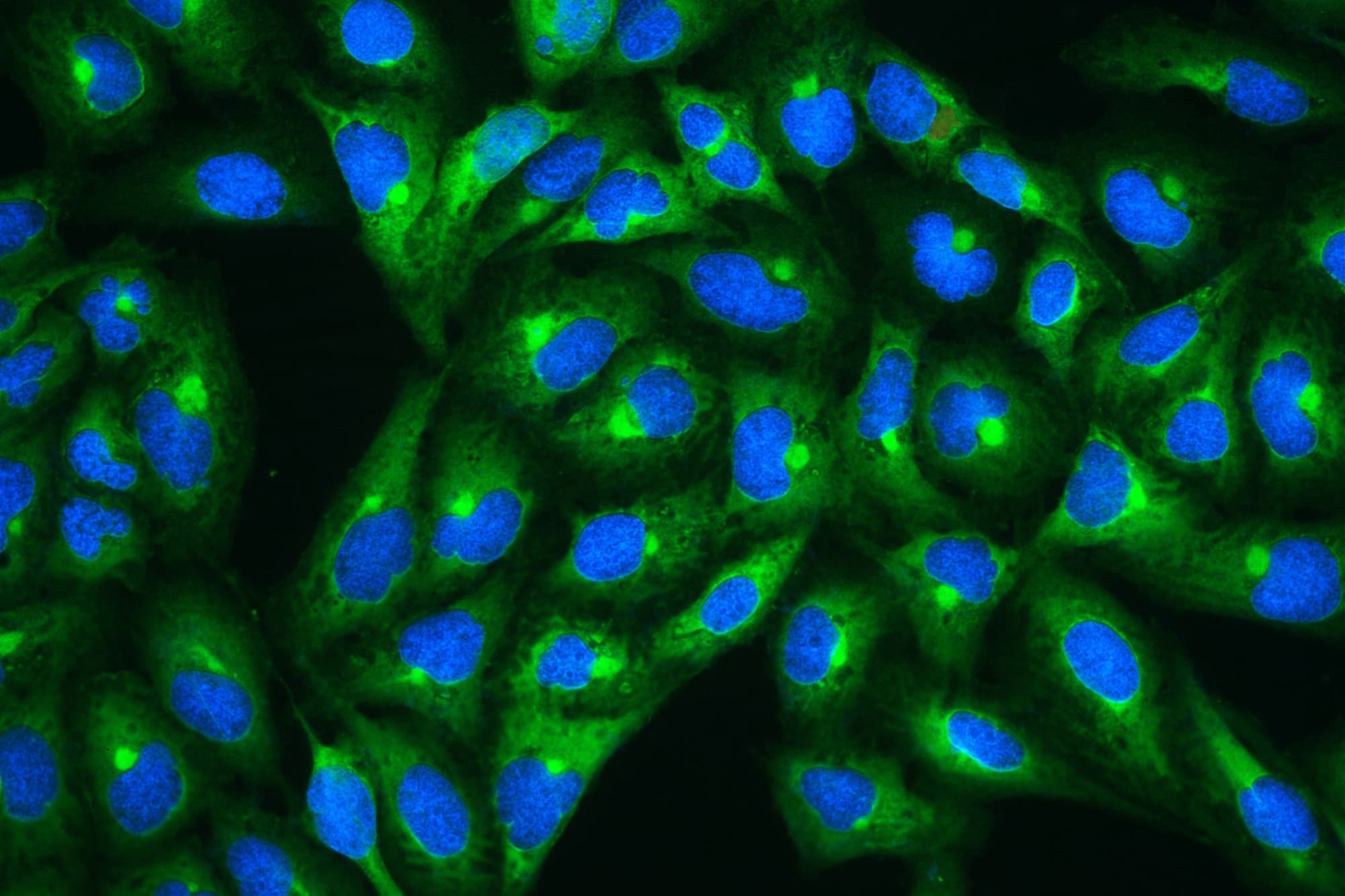 HSPB1 / HSP27 Antibody (aa1-205)