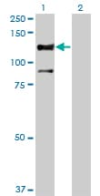 Monoclonal Mouse anti-Human STK31 Antibody (clone 1C10, WB)