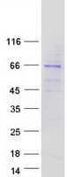 Human KLHL6 Protein (Recombinant Myc-DDK (Flag))