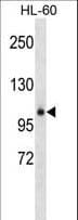 GPLD1 / GPIPLD Antibody (aa278-306)