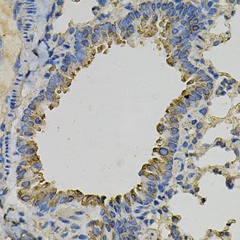 PSAT1 Antibody