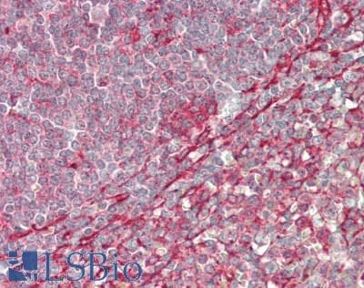 IHC-plus™ CLINT1 Antibody (aa250-300)