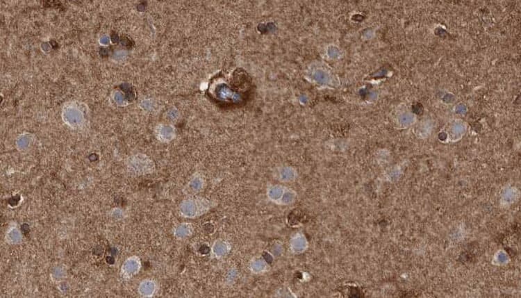 Polyclonal Rabbit anti-Human ACKR3 / CXCR7 Antibody (IHC, WB)