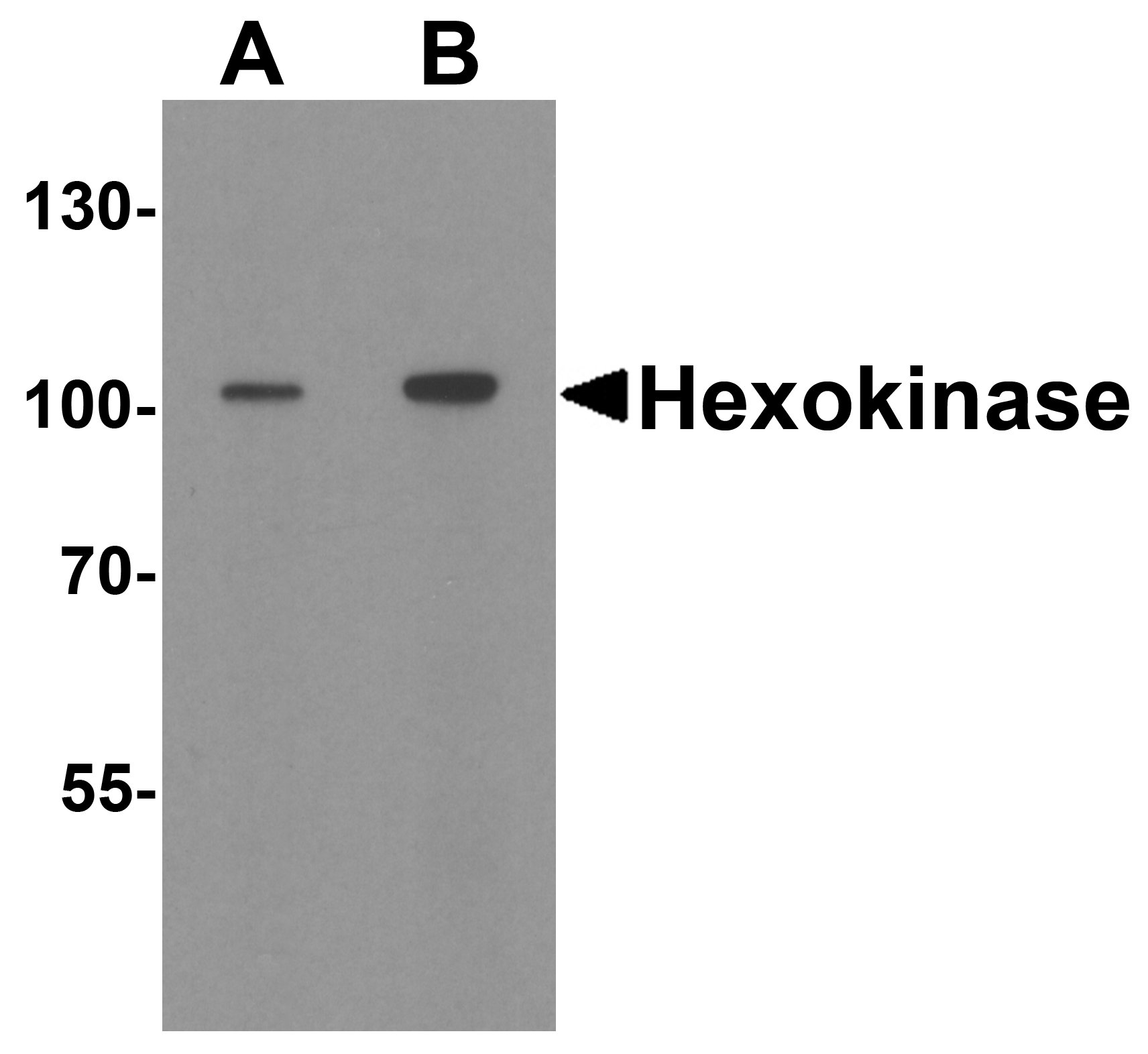 IHC-plus™ Polyclonal Rabbit anti-Human HK1 / Hexokinase 1 Antibody (IHC, IF, WB)