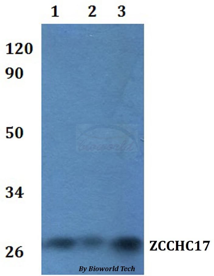 ZCCHC17 / PNO40 / PS1D Antibody