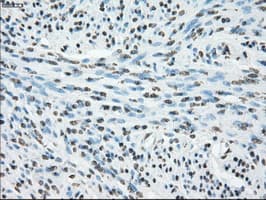 CYPOR / POR Antibody (clone OTI5B3)