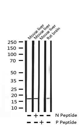 EIF4EBP1 / 4EBP1 Antibody (phospho-Thr36)