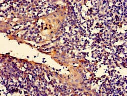 Polyclonal Rabbit anti-Human RIP1 / RALBP1 Antibody (IHC, IF, WB)