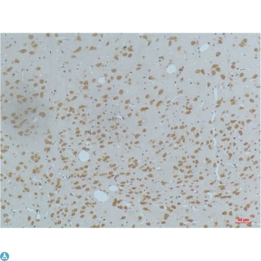 CaMKII Beta+Gamma+Delta Antibody (phospho-Thr287)