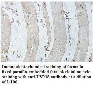 USP38 Antibody (aa41-241)