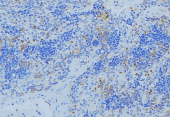 Polyclonal Rabbit anti-Human KRT36 / Keratin 36 / KRTHA6 Antibody (IHC, IF, WB)