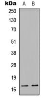 Polyclonal Rabbit anti-Human COXIV / COX4 Antibody (N-Terminus, IHC, IF, WB)