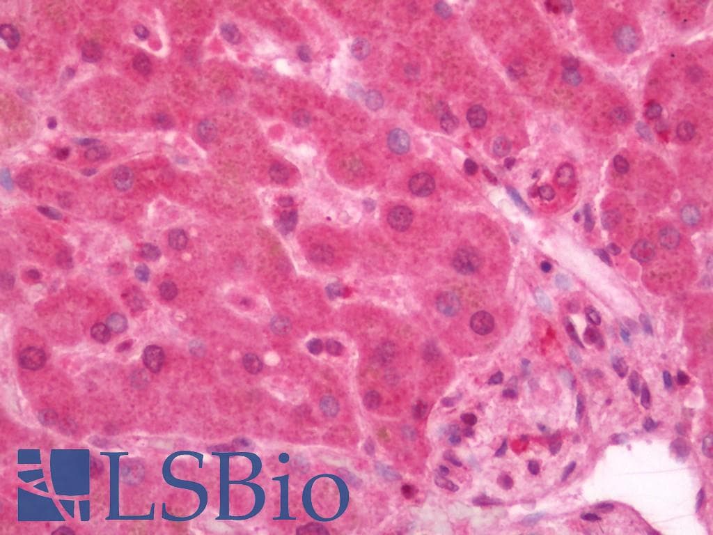 IHC-plus™ Polyclonal Rabbit anti-Human RICTOR Antibody (IHC, WB)