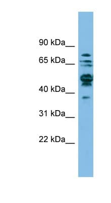 Polyclonal Rabbit anti-Human SHMT / SHMT1 Antibody (aa35-84, WB)