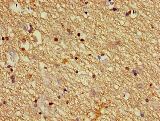 Polyclonal Rabbit anti-Human DPYSL2 / CRMP2 Antibody (IHC, IF, WB)