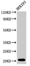 RPS10 / Ribosomal Protein S10 Antibody