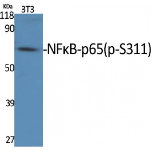 Polyclonal Rabbit anti-Human RELA / NFKB p65 Antibody (250-330 aa, IHC, IF, WB)