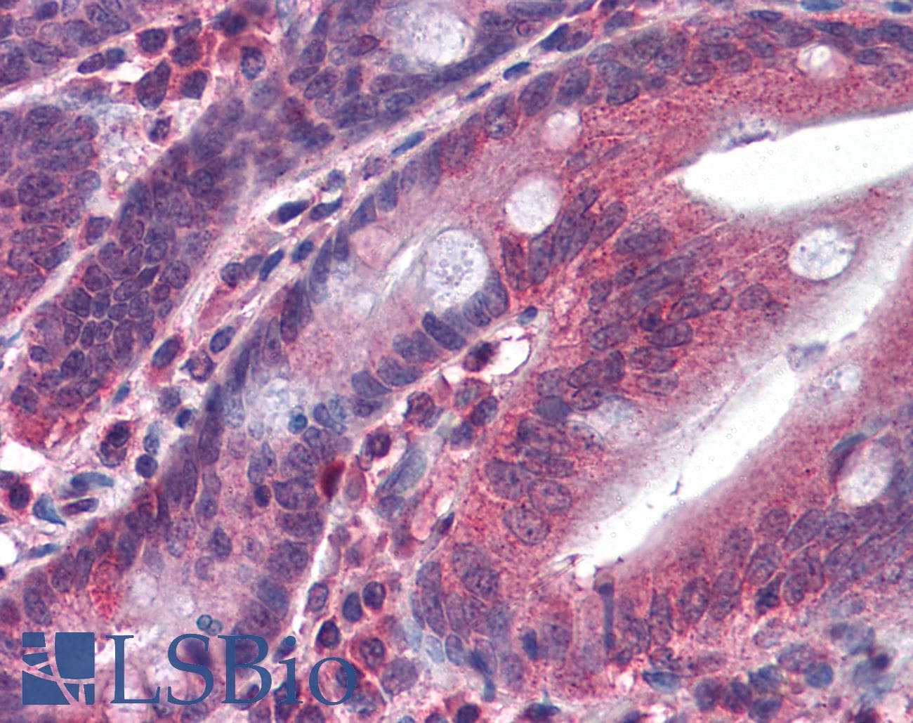 IHC-plus™ Polyclonal Goat anti-Human MGLL / Monoacylglycerol Lipase Antibody (aa17-29, IHC, WB)
