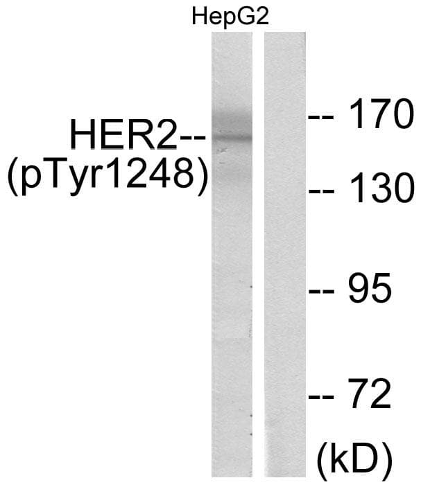 Polyclonal Rabbit anti-Human ERBB2 / HER2 Antibody (phospho-Tyr1248, IHC, WB)