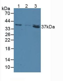 NT5C3A Antibody (aa52-336)