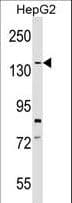 SCP1 / SYCP1 Antibody (aa927-955)