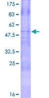 Human TRAIL-R3 / DCR1 Protein (Recombinant GST)