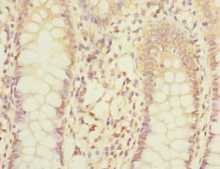 Mannose Phosphate Isomerase Antibody