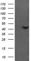CATIP / C2orf62 Antibody (clone OTI4B4)